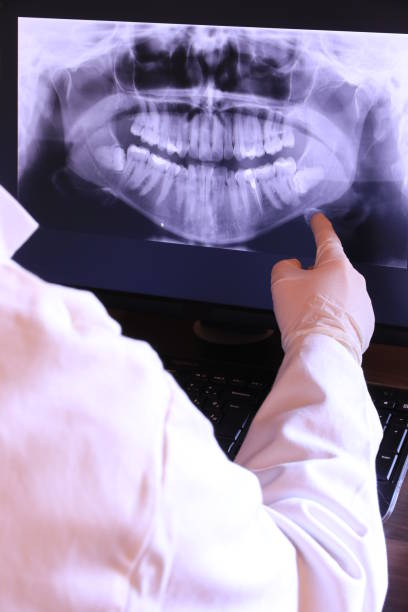 Best Broken or Cracked Tooth Emergency Dentist in Sto Brook, NY